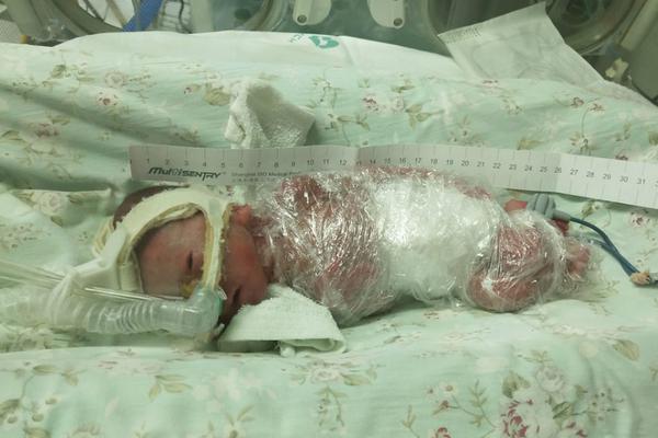 Local police solved a theft case using DNA evidence from a crime scene