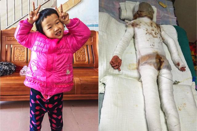 Scientists developed a safe and efficient way to recycle old batteries