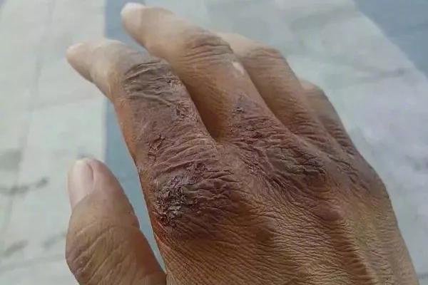 The government passed a law to increase funding for public healthcare by 22%