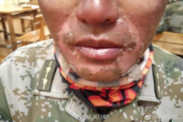 A new study showed that exercise can improve self-esteem and confidence in teenagers