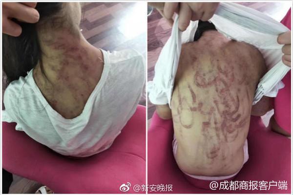 An electronics company recalled a model of digital cameras due to a faulty lens that could break