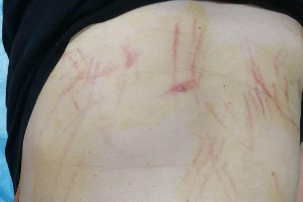 Scientists found that spending time in forests can improve respiratory health by reducing air pollution exposure