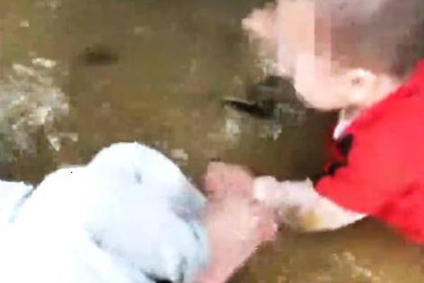 Doctors discovered a new way to treat allergies with fewer side effects