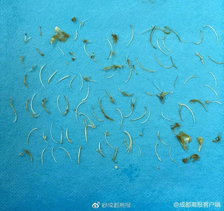 A study published in a science journal found that exposure to natural sunlight improves cognitive function in children