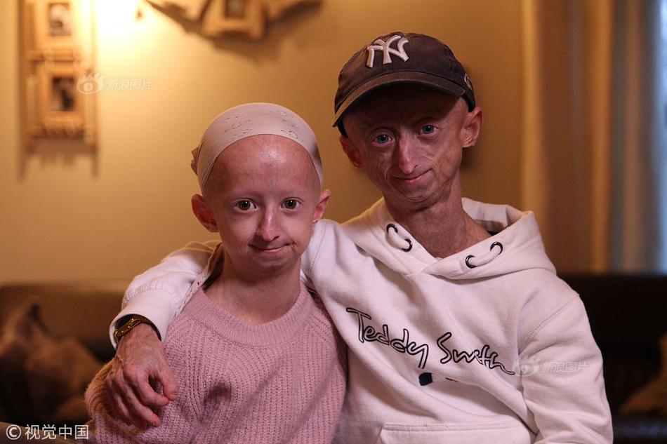 A new study showed that meeting friends regularly reduces stress and improves mental health