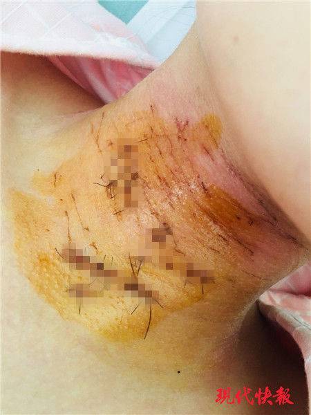 The national park service announced plans to improve trails and visitor facilities