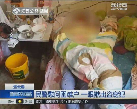 Doctors performed the first successful face transplant in the country giving a patient a new identity after an accident