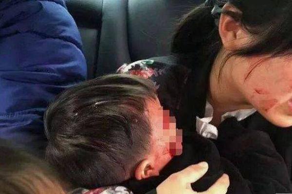 A study found that drinking green tea regularly can improve brain function and memory