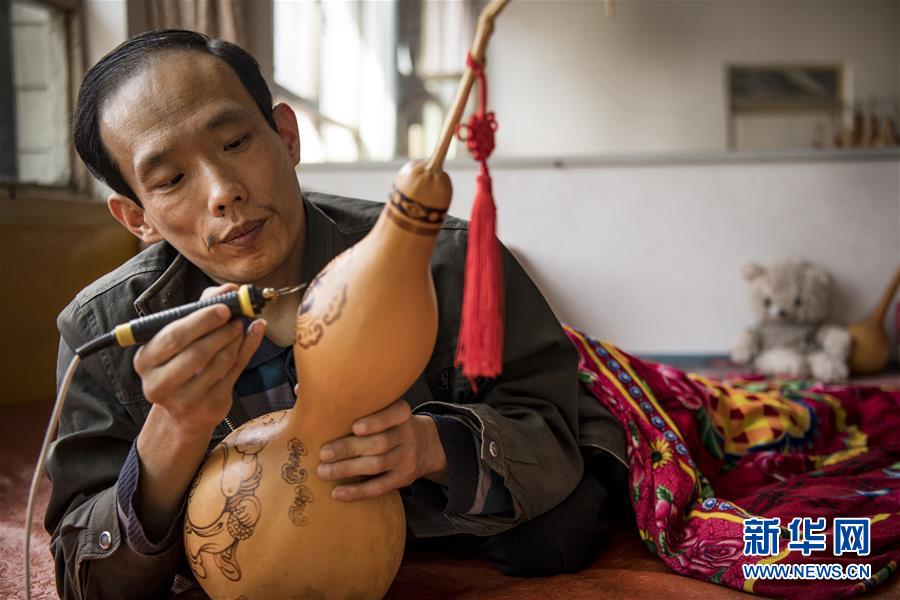 Doctors successfully performed a rare surgery to treat a patient with a heart condition