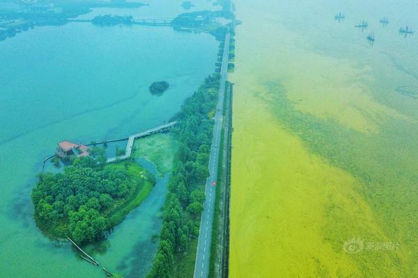 Hospital introduces new robotic surgery system to improve precision in orthopedic procedures