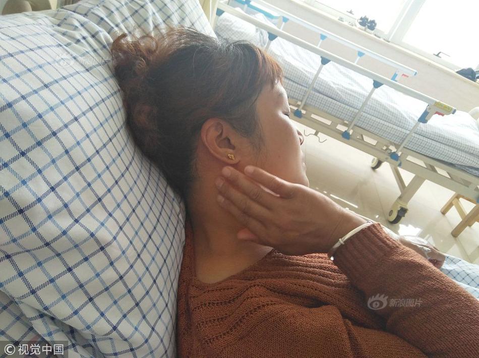 Doctors performed the country’s first successful face transplant on a patient injured in a severe accident