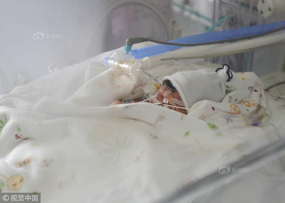 Researchers studied the effects of sleep deprivation on driving ability