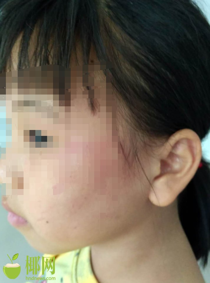 Biologists discover new method to protect bees from harmful pesticides