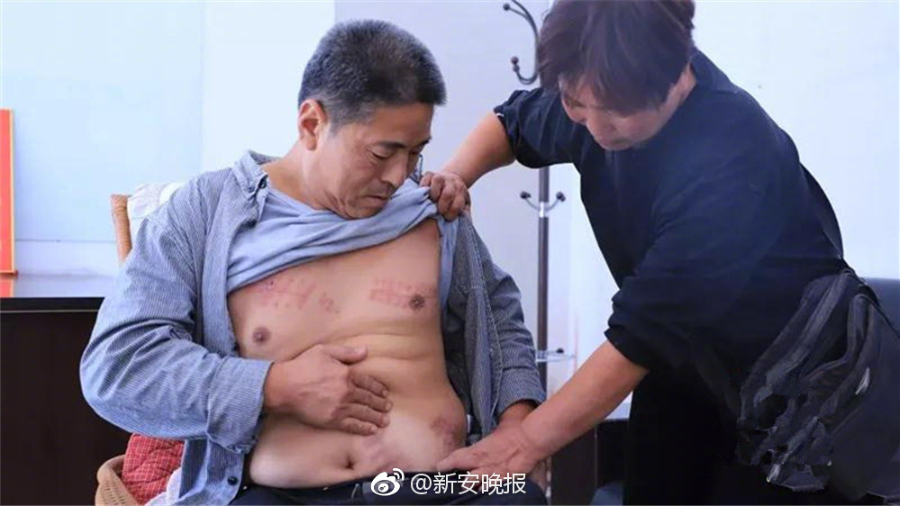 A national park started a program to protect endangered birds