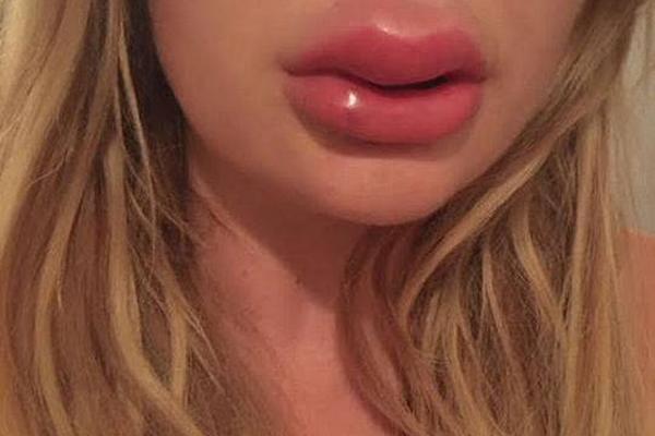 Researchers studied the effects of social media on mental health in teenagers