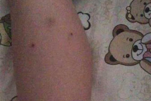 A severe heatwave swept across the southern region, prompting health officials to open cooling centers for vulnerable residents.